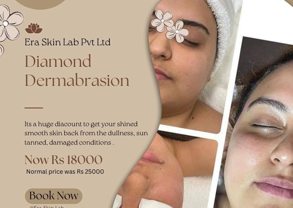 Diamond Microdermabrasion