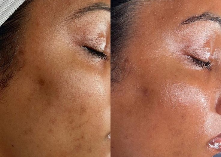 Bleaching Damage Repair