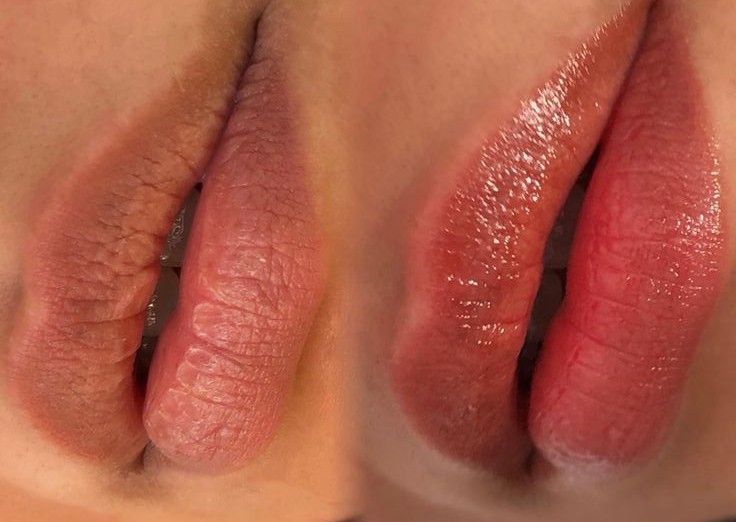 Hydra Glossy Lips
