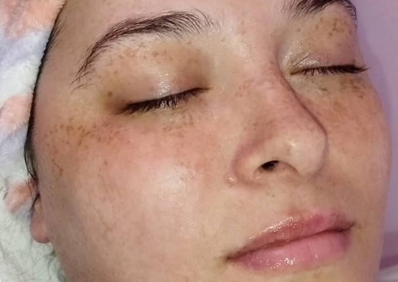 Limpieza facial
