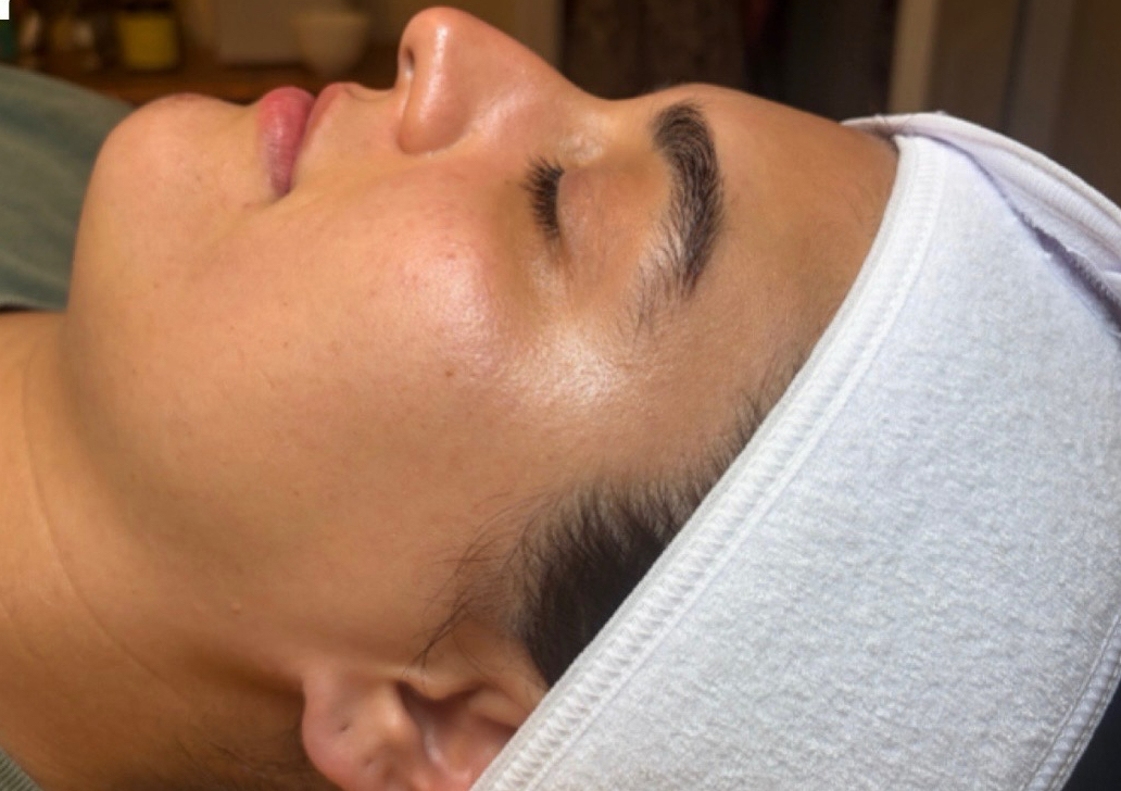 Dermaplaning Treatment