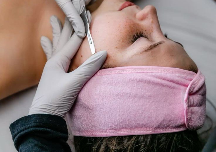 Dermaplaning facial 