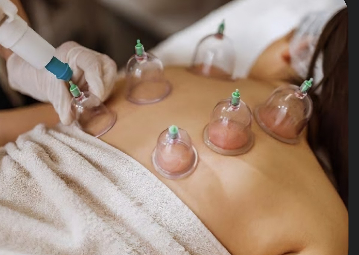 Back Cupping Therapy