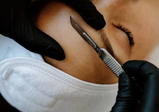 Dermaplaning