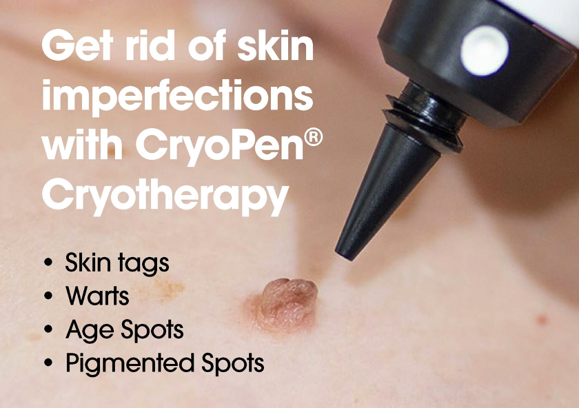 Additional session cryopen