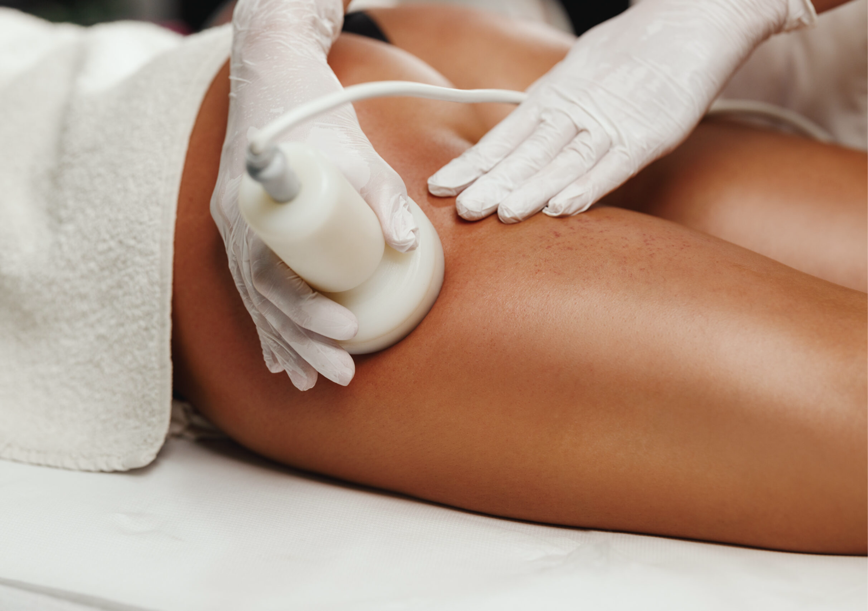 Body Cavitation & Radio Frequency -Fat & Cellulite Removal 