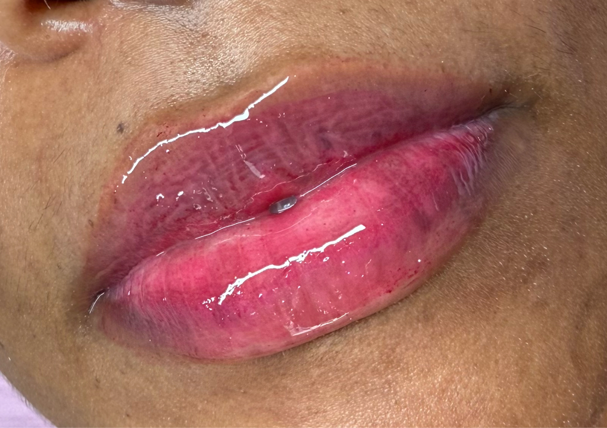 Hydra gloss lips
