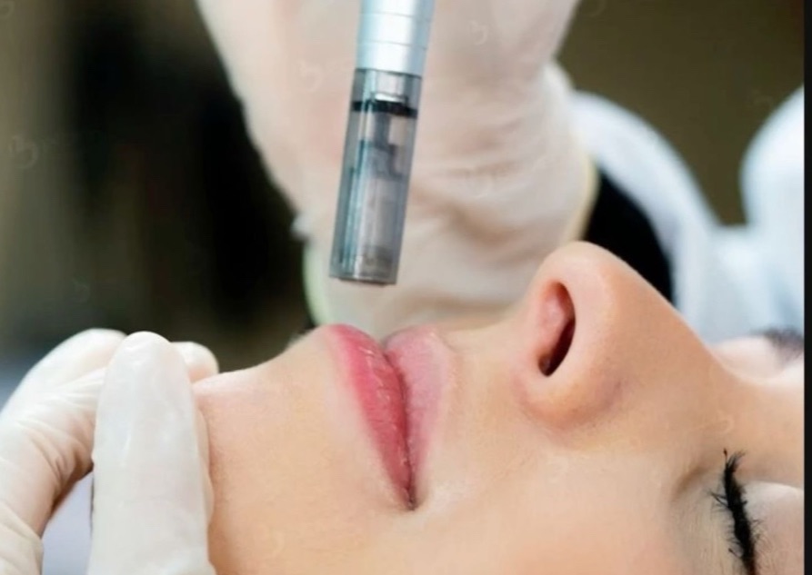 Hydra Lips (Deep lip hydration)