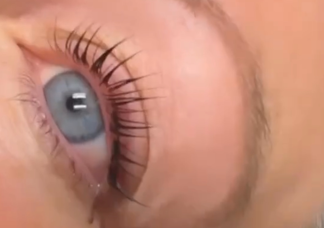 eyelash lift
