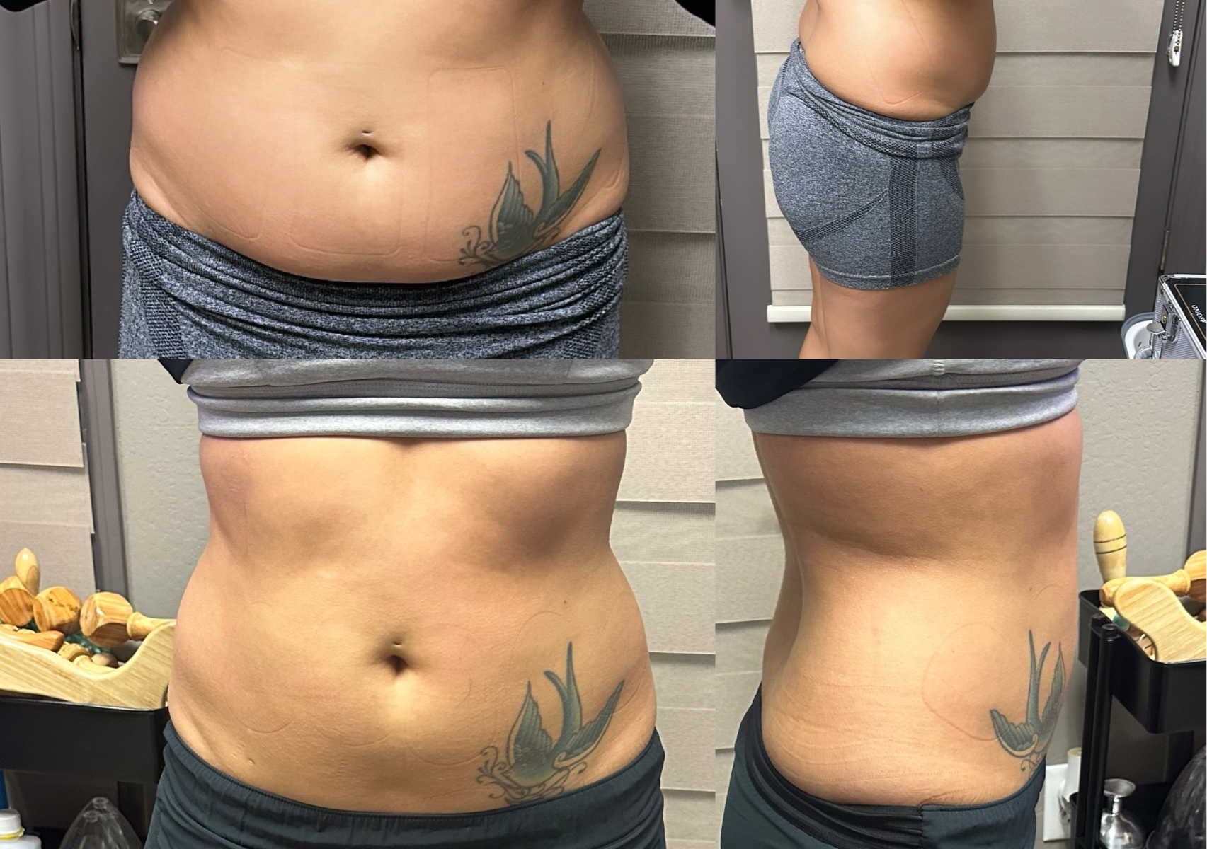 Snatched single session